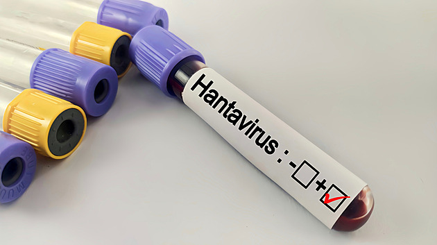Hantaviry přenášené hlodavci útočí i v Česku. Smrt lesníka objasnila až pitva